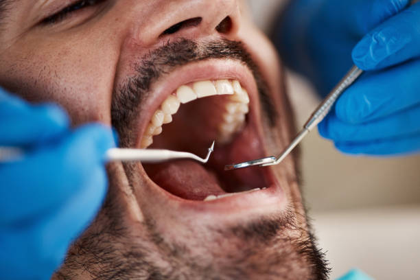 Best Oral Cancer Screening  in Ada, OK
